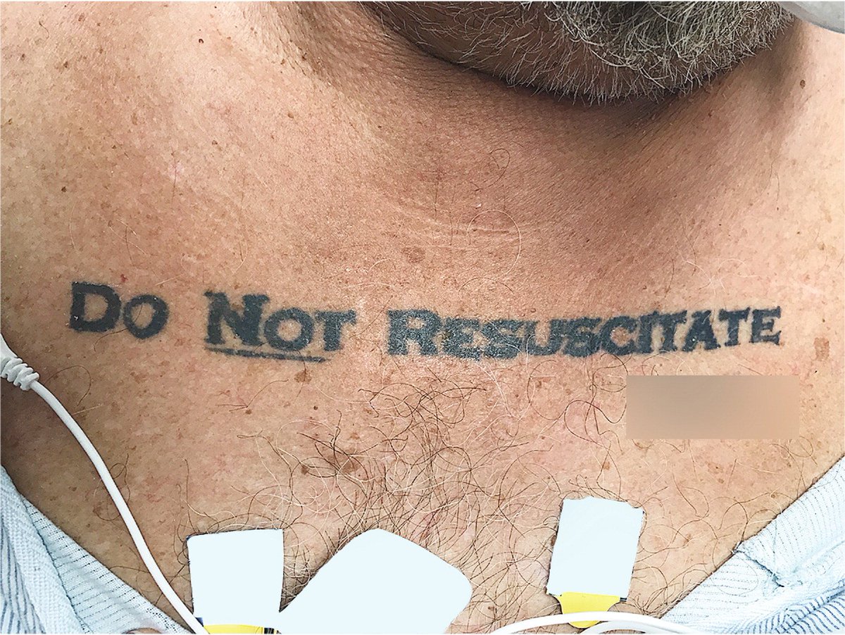 Unconscious patient with "Do Not Resuscitate" tattoo causes ethical conundrum at hospital gizmo.do/0IaMxg2