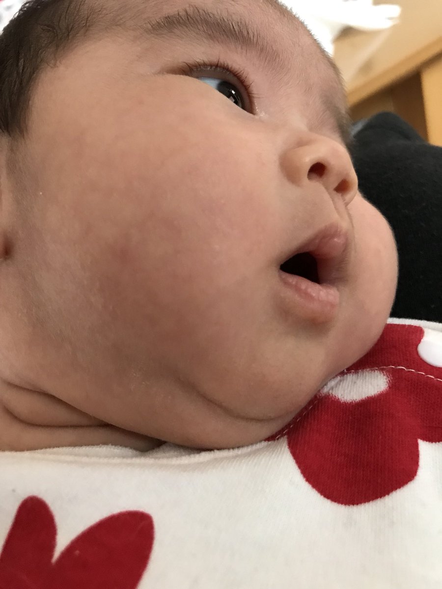 赤ちゃん 二 重 あご 二重あご解消の方法って あご周りをスッキリさせるエクササイズでたるみとサヨナラ 赤ちゃん 二 重 あご 二重あご解消の方法って あご周りをスッキリさせるエクササイズでたるみとサヨナラ