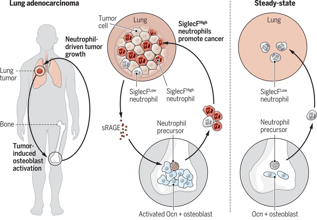 Bone cells know when there's a lung tumor--then send out immune cells that make it worse! Latest publication from the <a href="/PittetLab/">The Pittet Lab</a> this week in Science <a href="/camillaengblom/">Camilla Engblom</a> science.sciencemag.org/content/358/63…