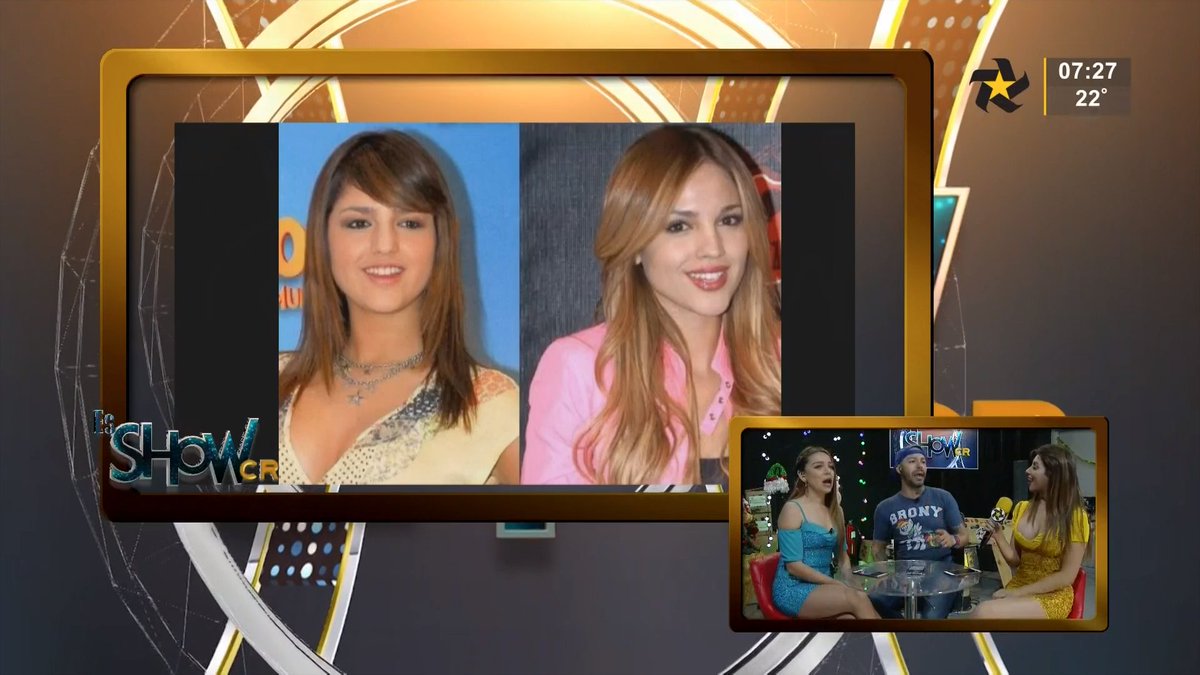 multimedioscr's tweet photo. #EsShowCR Operaciones de artistas y algunos que llegan a los extremos 📺

EN VIVO ▶️https://t.co/Dnaxe6RIzc https://t.co/fAxPnk0E73
