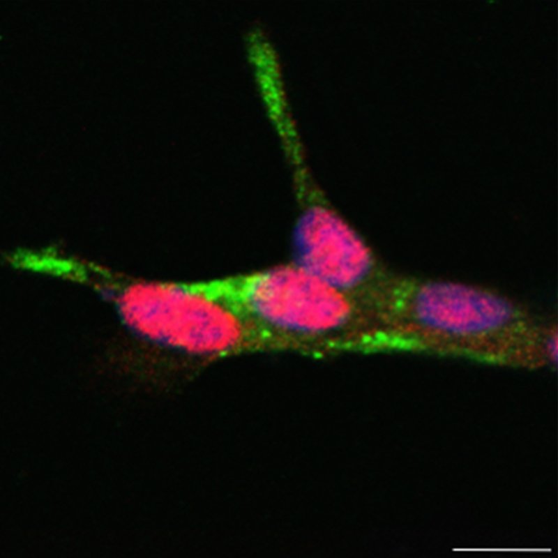 PLID_Info's tweet photo. Another research paper is out: @PLID_Info scientists, togehter with collaboration partner from @sanofiDE, @ISBSIB as well as @Unipisa identified novel transcirptomic signature of #type2 #diabetic #islets within European #IMIDIA consortium. https://t.co/4wH0uhpFjV https://t.co/iH94VZ3sbs