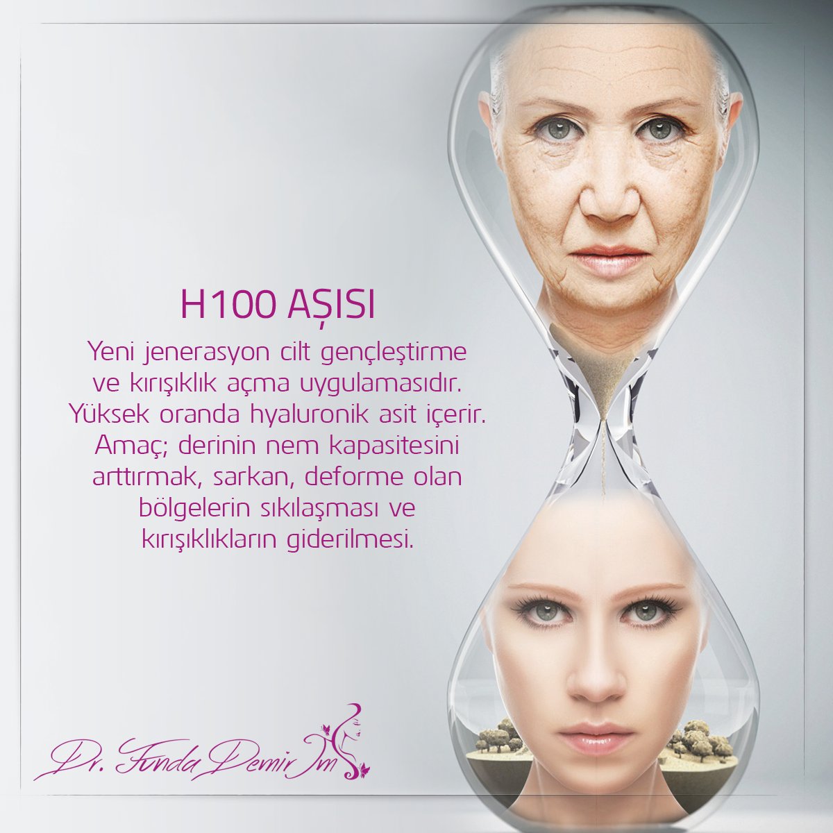 Yeni jenerasyon cilt gençleştirme ve kırışıklık açma uygulamasıdır. Yüksek oranda hyaluronik asit içerir. Amaç; derinin nem kapasitesini arttırmak, sarkan, deforme olan bölgelerin sıkılaşması ve kırışıklıkların giderilmesi. #H100 #H100aşısı #ciltgençleştirme #DrFundaDemirİm