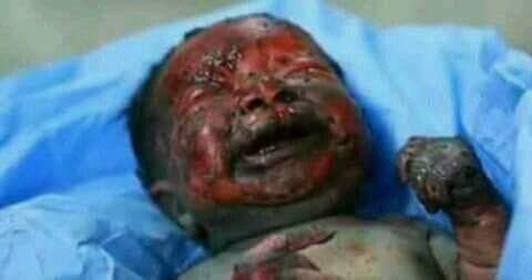 jawanalbadry88's tweet photo. #السعوديه_تقتل_الطفوله
حسبي الله ونعيم الوكيل . الحجه هو حماية الشرعيه ونست #الشريعه_الاسلاميه https://t.co/qHA1rwzjvy