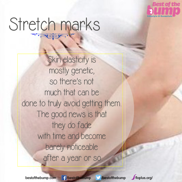 BestOfTheBump's tweet photo. #stretchmarks #pregnancy #PregnancyProblems #skincare https://t.co/jUkEV1SK81