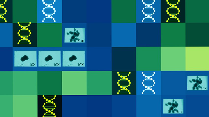 Can we truly eliminate #HIV from the body? This discovery made in our labs offers hope -- if science can find a way to flush the virus from #bonemarrow: michmed.org/QJllx #WorldAIDSDay2017