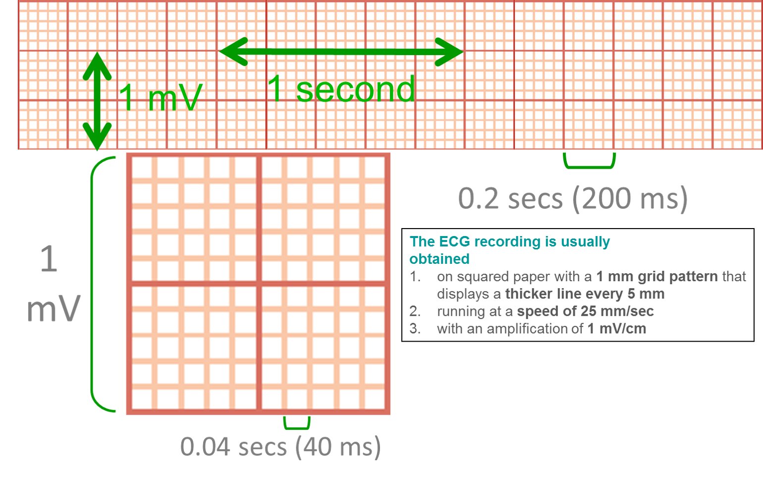 Ecgcorner Course Ecg Basic Principles Ecg Recordings Electrocardiography Ecglovers Foamed Ecg T Co Haqhjdn70n T Co Oui4yz18xn Twitter