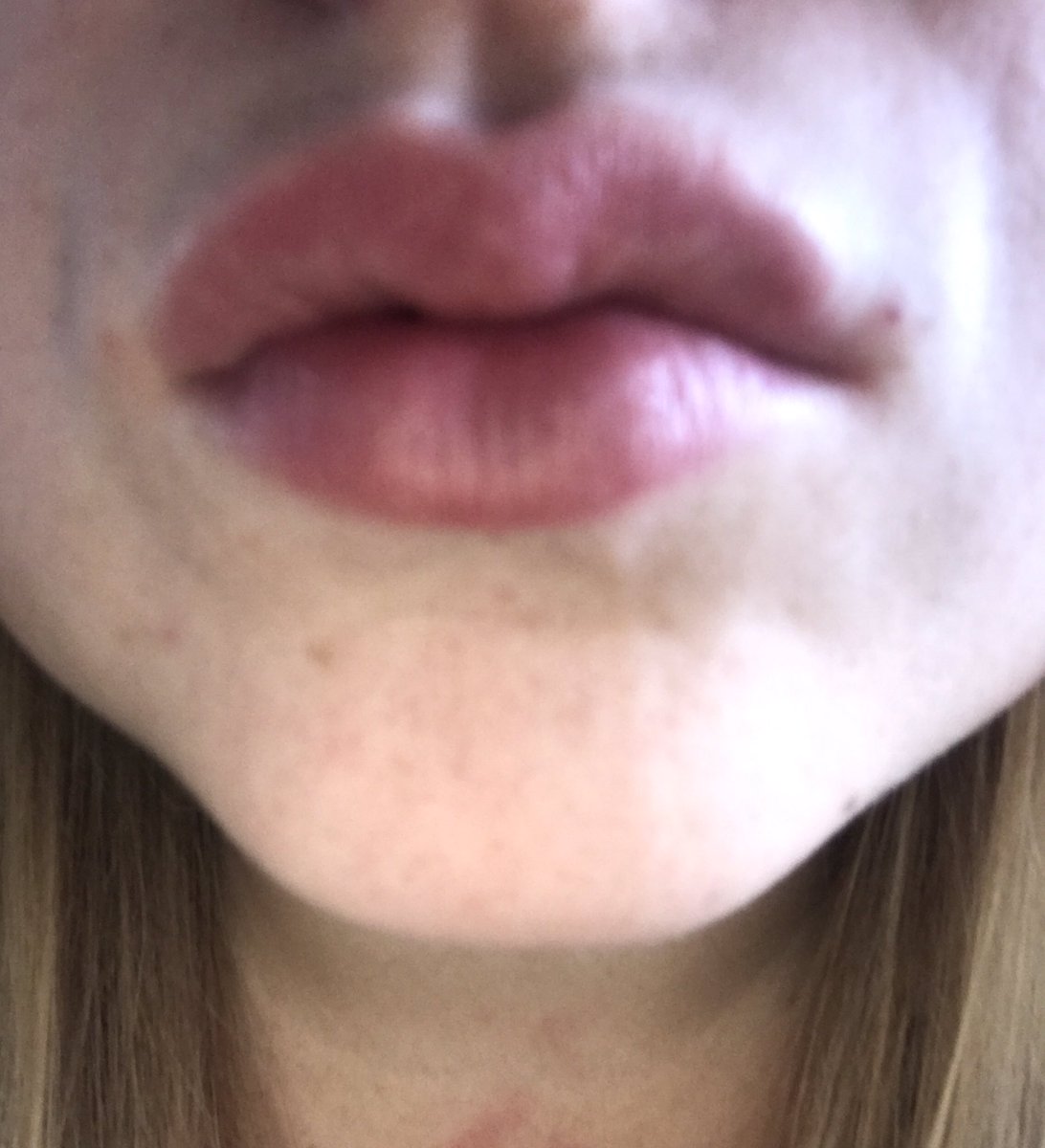 Dominant12331's tweet photo. These Natural lips are waiting for you to send me tribute now you useless pay pigs... https://t.co/685kIseStN 🐷🐽💸💵 #pay #paypig #paypiggy #findom #findomgoddess #findomm https://t.co/bgLxczFOz9