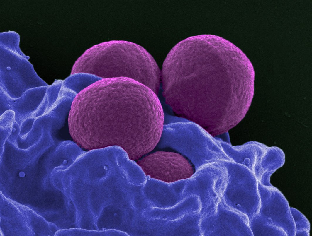 masbarberi's tweet photo. March of the #Microbes: Harnessing the Power of the Human #Microbiome to Improve Health and Target Disease. https://t.co/I5e9Tl25x5 https://t.co/8KIRczCxqy