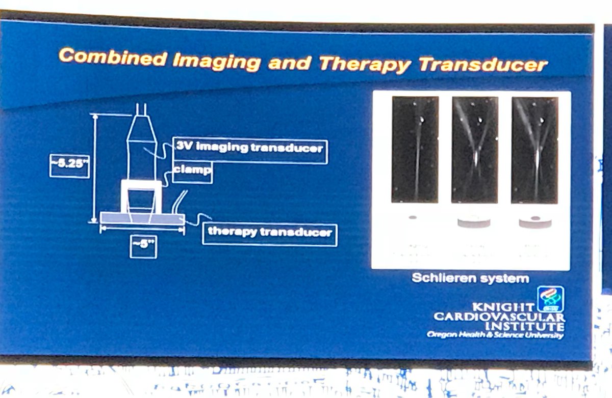 SGuptaMD's tweet photo. Ultrasound & contrast have many more implications than just imaging - Sanjiv Kaul #Echo #Imaging #SonoThrombolysis #CSICON2017 @robertomlang @AmitRPatelMD @AkhilNarangMD @purviparwani @DrMarthaGulati @rahatheart1 @jbbhalke @AnastasiaSMihai https://t.co/XNoXrbRgNt