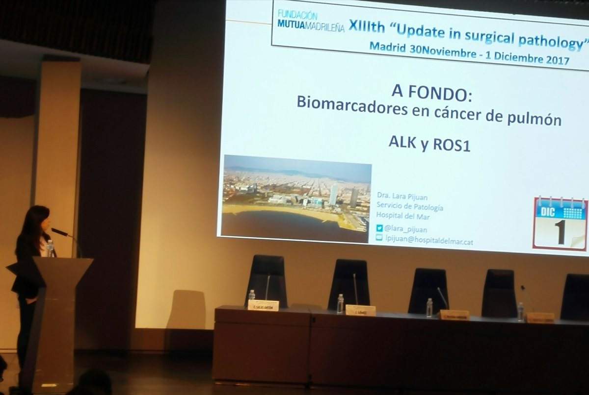 Histopatolomon's tweet photo. @lara_pijuan talking about #alk and #ros1 in lung cancer. #UpdateMM2017 @SEAP_IAP #lungcancer #pathology #pulmpath https://t.co/DsKHWNwouS