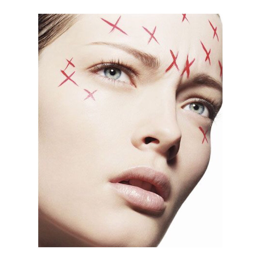 greglebrasseur's tweet photo. Did you know there’s more to anti-wrinkle injections than just anti-ageing and rejuvenating? Anti-wrinkle injections help with migraines and sweating too! 
Get in contact with our team today, to find out how we can help YOU too!
📱: 07496012010
📍: Blakedown, Worcestershire https://t.co/kGIvEAkAe2