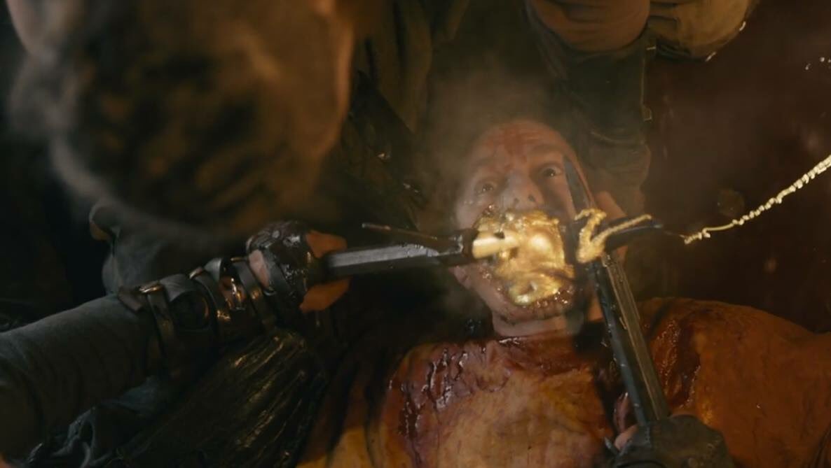 Say "ahh!" Ivar the Dentist is in the building.

#Vikings
#IvarTheRuthless