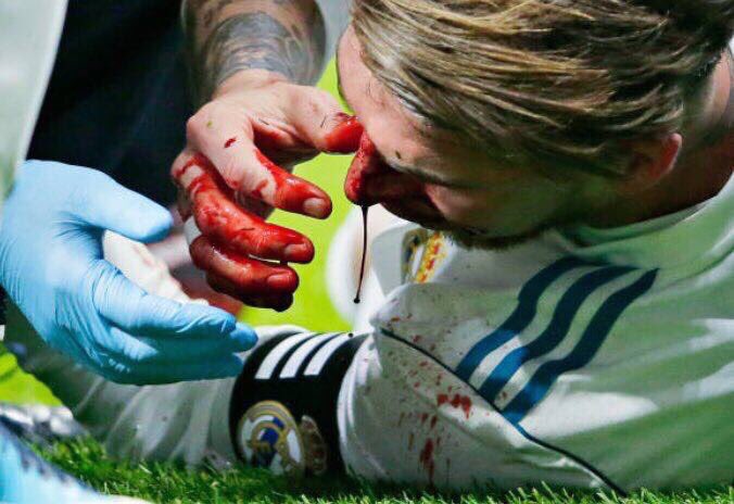 diosflorentino's tweet photo. Esta imagen pasará a la historia. Gracias por partirte la cara por este escudo @SergioRamos #Halamadrid https://t.co/7ykJsYKr4g