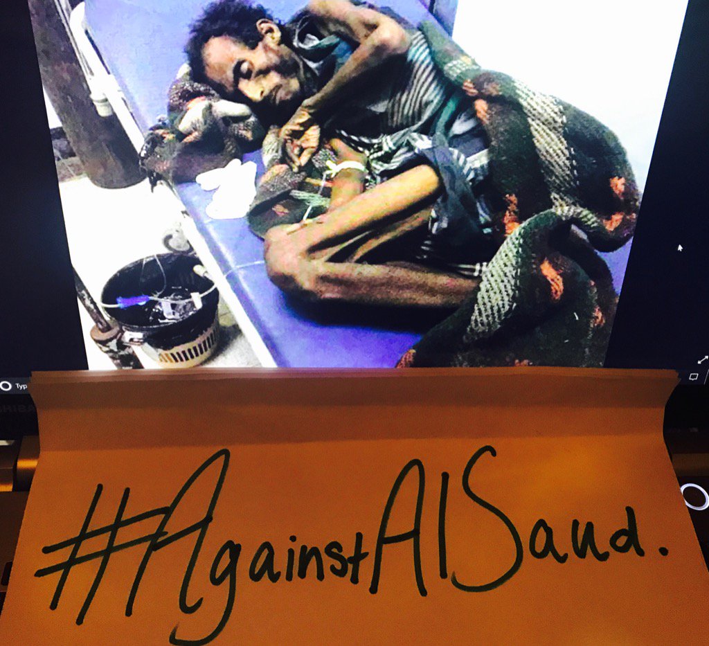 VanessaBeeley's tweet image. #Holocaust #Yemen. Genocide on our watch. U.K. US EU UN assisted massacre by #KSA coalition. #AgainstAlSaud