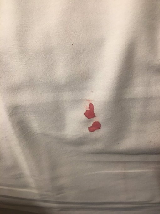 So glad I came to @LuxorLV for my birthday, they messed up our room then through in complimentary BLOOD<a class="tags" target="_blank" title="On Twitter" href="/?out=eyJ0eXAiOiJKV1QiLCJhbGciOiJIUzUxMiJ9.eyJpYXQiOjE3MjU4MjM4MjcsImlzcyI6InR3cG9ybnN0YXJzLmNvbSIsIm5iZiI6MTcyNTgyMzgyNywiZXhwIjoxNzU3MzU5ODI3LCJyZWRpcmVjdF91cmwiOiJodHRwczovL3R3aXR0ZXIuY29tL0x1eG9yTFYifQ.Z3Ox-3P37ijVOfVWwut5ppYQoFNDby6WzK5ePEa2B-JQQ7F0RoiOJrbZHZry0DKhrKDVscasUtY9Im1iGNFjCA">@LuxorLV</a><a href="/tag/worstbday"class="tags"><span>#worstbday</span></a>