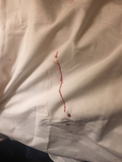 So glad I came to @LuxorLV for my birthday, they messed up our room then through in complimentary BLOOD<a class="tags" target="_blank" title="On Twitter" href="/?out=eyJ0eXAiOiJKV1QiLCJhbGciOiJIUzUxMiJ9.eyJpYXQiOjE3MjU4MjM4MjUsImlzcyI6InR3cG9ybnN0YXJzLmNvbSIsIm5iZiI6MTcyNTgyMzgyNSwiZXhwIjoxNzU3MzU5ODI1LCJyZWRpcmVjdF91cmwiOiJodHRwczovL3R3aXR0ZXIuY29tL0x1eG9yTFYifQ.O6MF2aG-p8kf5HgzdBldyTTNM7sStGct1JiVGqerQI5k_tM7N9_dnPg3bRUjYSbSroVy3RMYxs1fe6dUiXIn5g">@LuxorLV</a><a href="/tag/worstbday"class="tags"><span>#worstbday</span></a>