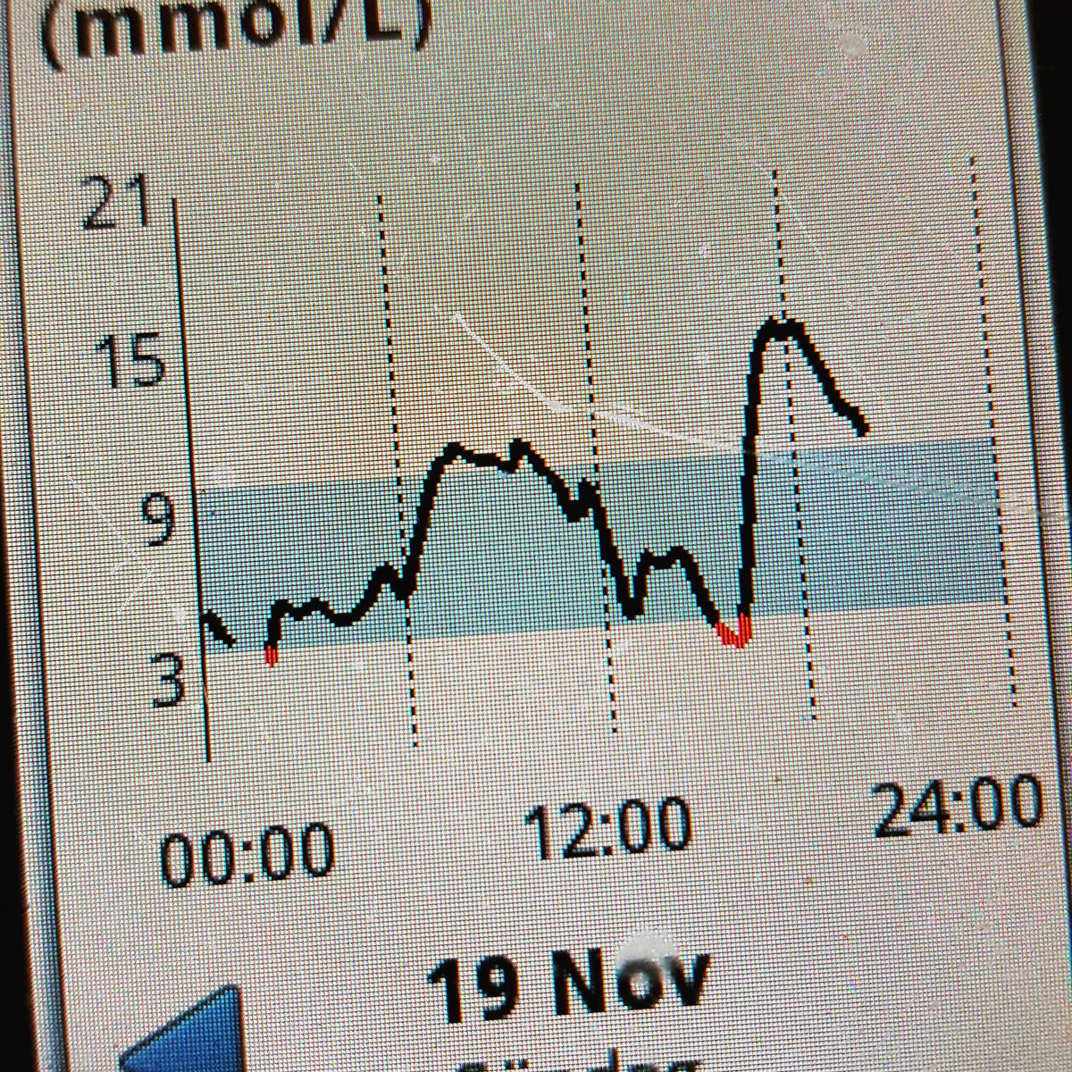 pernillaerikson's tweet photo. Idag ber jag min diabetes att dra åt helvete! #diabetes #diabetestyp1 #levautanattdö https://t.co/kEjZM5r0RD