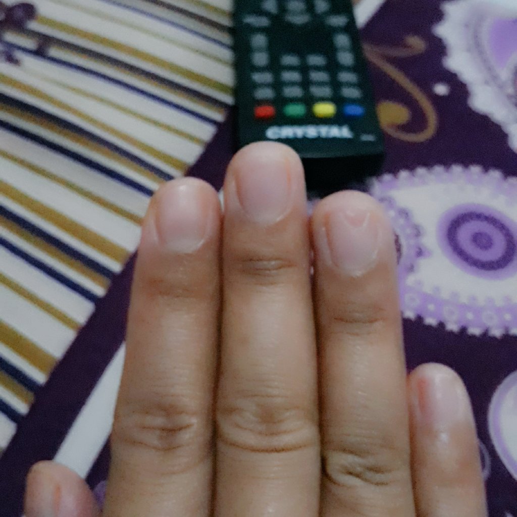 Dheadhe_94's tweet photo. Seminggu kemudian.... https://t.co/f0MTn07J1S