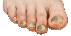 MedicalPedi's tweet photo. Are you having trouble with thickening toe nails? This could be occurring for many reasons. Have a read of this article to find out what you can do about it.
https://t.co/CaOJbBKhNB

#thick #toenails #nails #pedicure #medical #podiatry #podiatrist #healthy #feet https://t.co/BEpLC1Gqiz