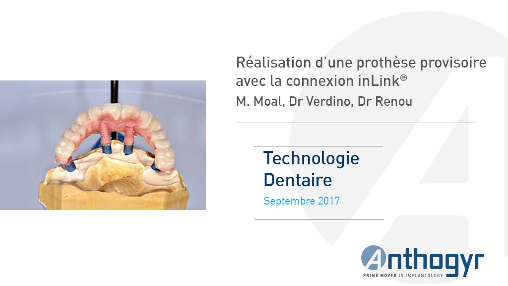Anthogyr_France's tweet photo. Extraction-implantation et mise en charge immédiate avec #implants Axiom® #tissuelevel. Réalisation de 2 bridges complets provisoires avec la connexion inLink® par Jean Michel Moal, prothésiste dentaire : https://t.co/ssmkjLES0D https://t.co/mFPB3VnZ1I