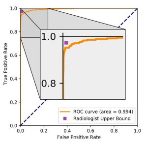 DrLaurenOR's tweet photo. Our new paper: "Detecting hip fractures with radiologist-level performance using deep neural networks".
55,000 hip x-rays, big improvement over SOTA, AUC 0.994 (!). Huge team effort, especially from my exceptional co-author William Gale (an undergrad!)
https://t.co/C5OoItBx9l https://t.co/rLJy6GTeVX