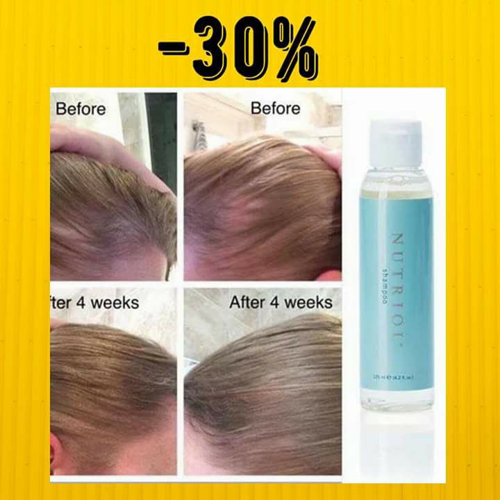 BernardD1981's tweet photo. Black Friday Only #BlackFriday #hair #haircare #healthyhair #hairgrowth #preorder https://t.co/iGi0h2itTL
