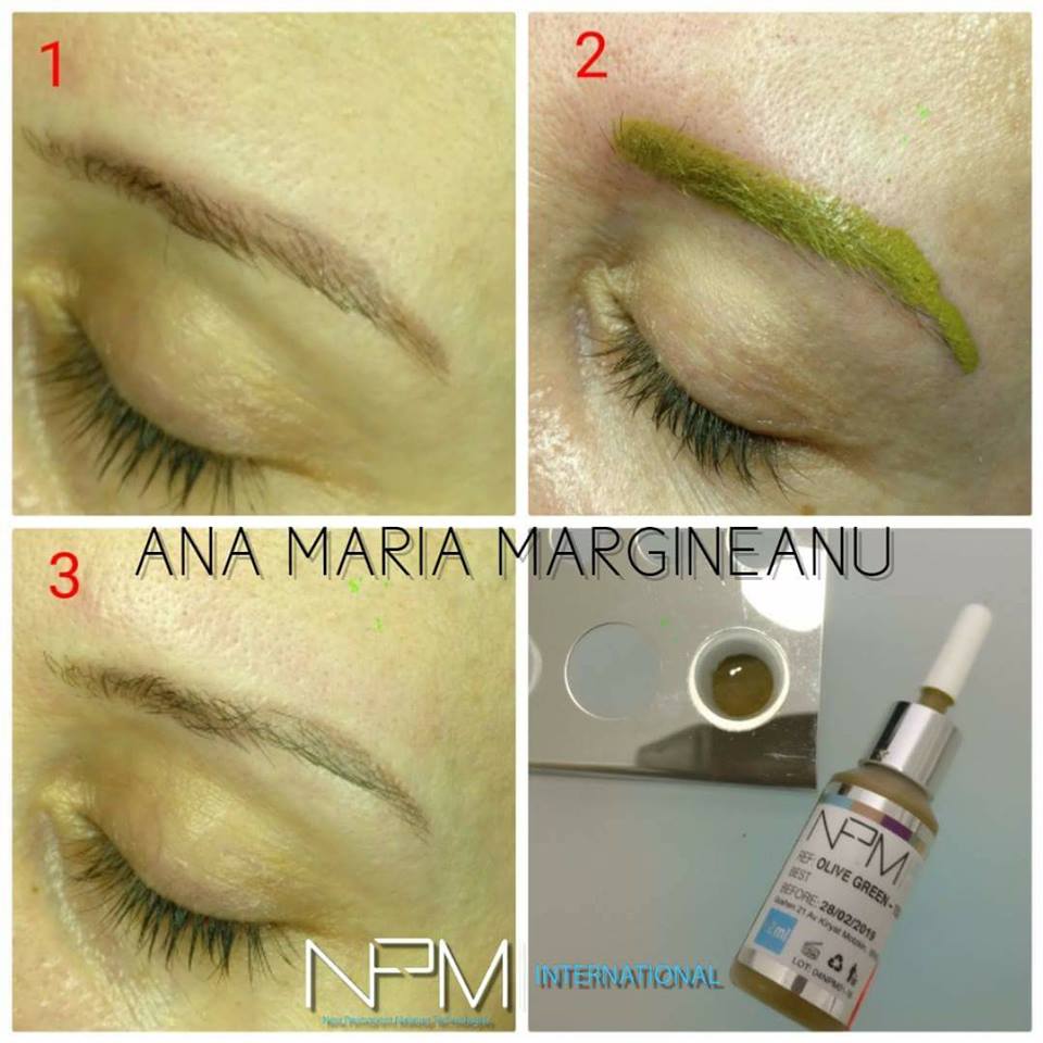 MariaMargineanu's tweet photo. You can cover it with brown pigment but it  will show again and again on the surface.
 If the shape helps you,  all you have to do, is neutralize the red colour with the right green  and after that, you are free to do permanent make up with the colour you  choose! https://t.co/KPDnyHofjO