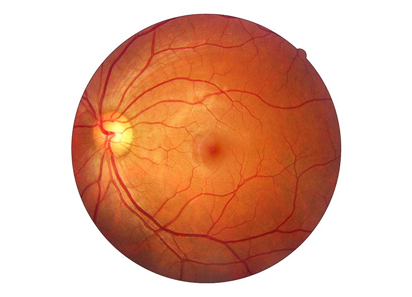 Ophthinpractice tweet picture