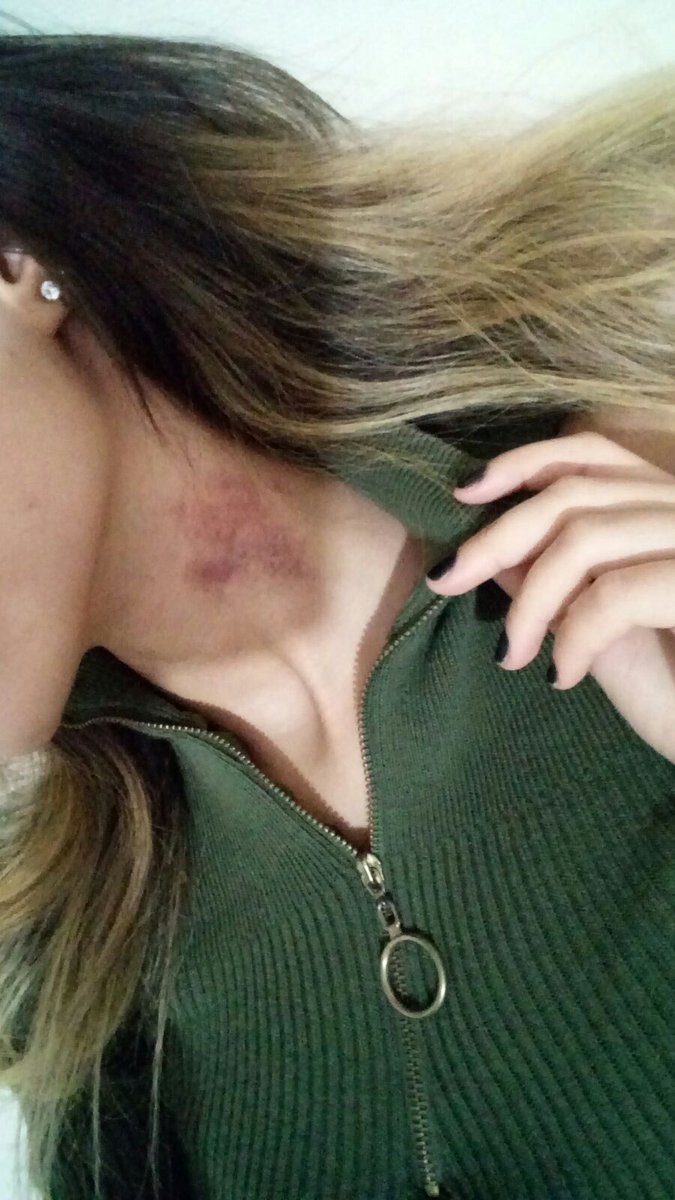Alienqueenxx1's tweet photo. Bugünde emdirdik 👅 Rt atanlara dm atıyorum 👅 #ensest #liseliifşa #boobs #sex #girl #girlpower #girls #hotgirl #türkifşa https://t.co/XJHFu8qJpq