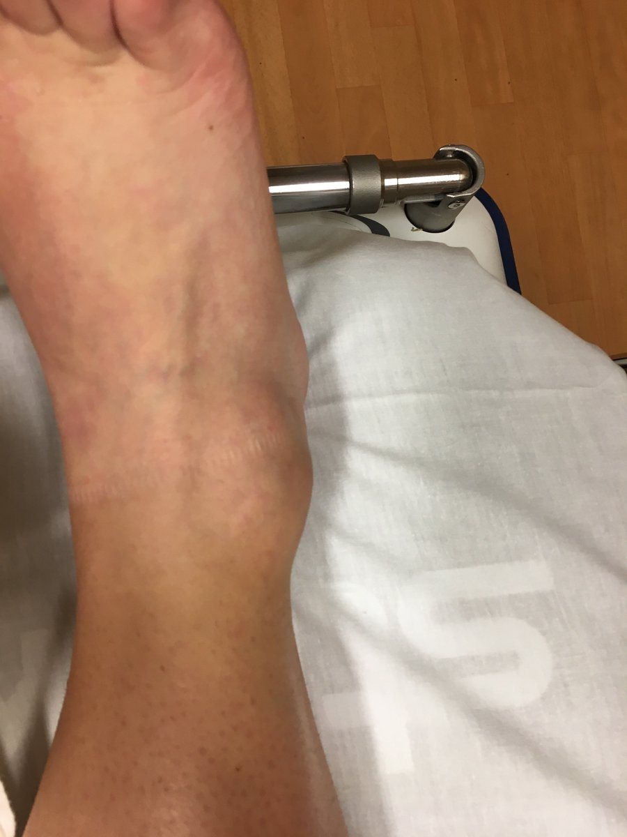 kmmiller1706's tweet photo. #imgettingtooldforthis #soccerprobs https://t.co/5i9rkhwI2t