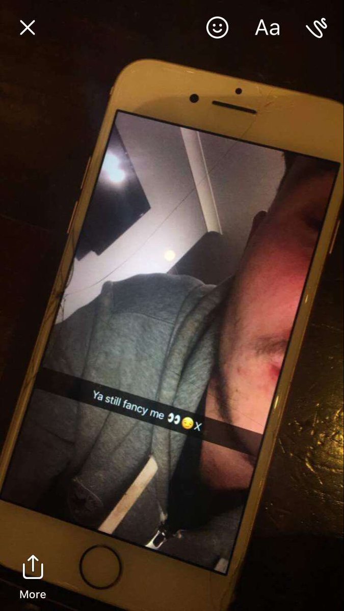 abi_thorpee's tweet photo. No bellend😷 #cringe #getashave https://t.co/sWoOy7yzLP