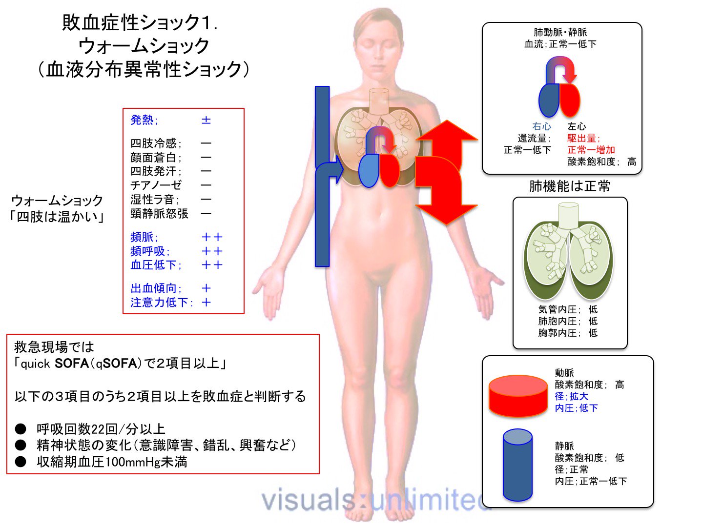 Oj Tren Twitter 敗血症2 ウォームショック T Co Zt18bn2jzj Twitter Oj Tren Twitter 敗血症2 ウォームショック T Co Zt18bn2jzj Twitter