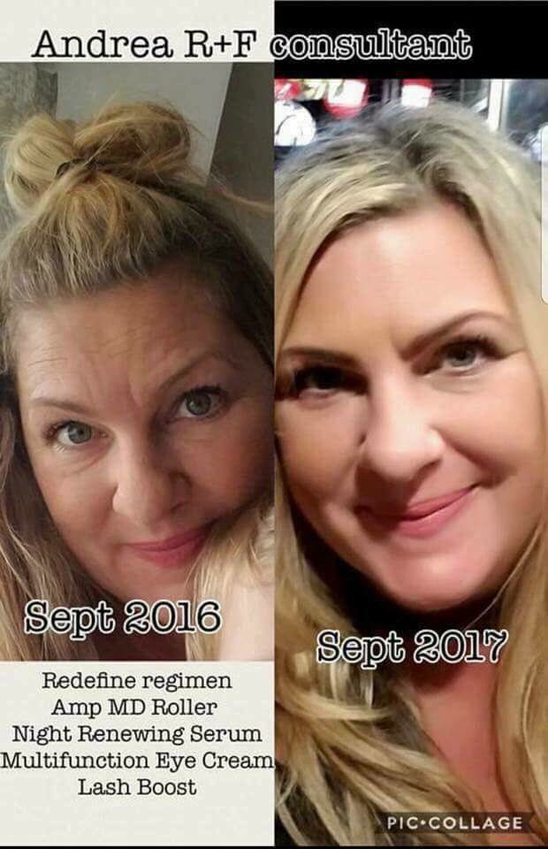 SuzieSakata's tweet photo. This is โaging backwardsโ at its finest.
#rodanandfields
#redefine
#eyecream
#ampmdroller
#lashboost https://t.co/M4CgTvgCRS