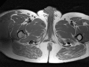 RadsourceLLC's tweet photo. A parasailing accident led to this diagnosis (named for a French surgeon).... #webclinic #radclinics https://t.co/KItZMouUSY