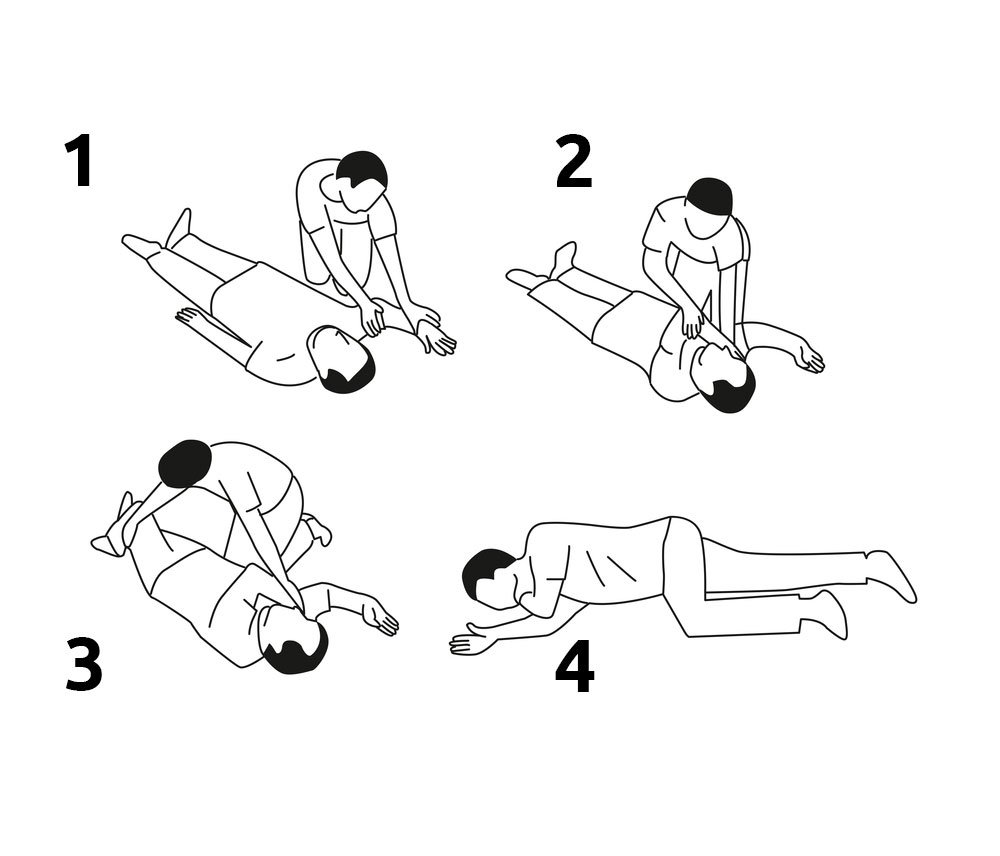 mohawkwellness's tweet photo. Recovery Position 101: Raise the person’s closest arm above their head; Prepare to roll them towards you; Gently roll as a unit; Guide their head as you roll them; Tuck nearest hand under the cheek to help maintain head tilt; Tilt head to maintain airway; Check on them often. https://t.co/ivH4CGsOBr