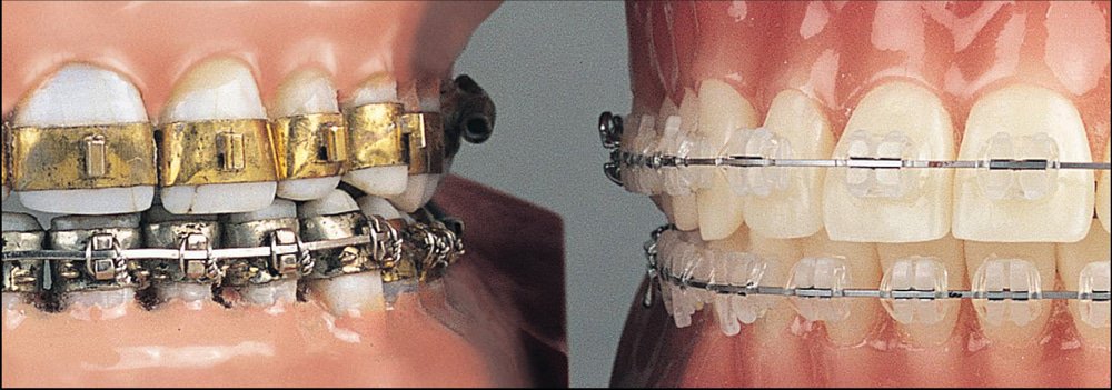 PennaOrtho's tweet photo. Orthodontics has been intimately linked with the history of dentistry for more than 2000 years #HealthyTeeth #PennaOrthodontics #Mooresville https://t.co/j5mM4wbLy5