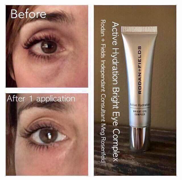 learnaboutskin's tweet photo. Is your eye cream living up to your expectations?  Check this out https://t.co/ByQkRR4m8H #eyes #eyecream #aging #wrinkle #eyebags https://t.co/JnrhKZMNrR