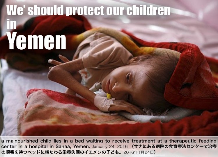 178kakapo's tweet photo. "130 children die every day in #Yemen, 'Save the Children' says 

https://t.co/PsdHBH1agh 
16 Nov 2017"

NGO：イエメンでは毎日130人の子供が死ぬ可能性がある
国連：サウジアラビアが反政府勢力に対して封鎖を解除しなければ、約15万人の栄養失調の子供が死ぬ可能性がある

#SaveYemenChildren https://t.co/I4NZm3TLSA
