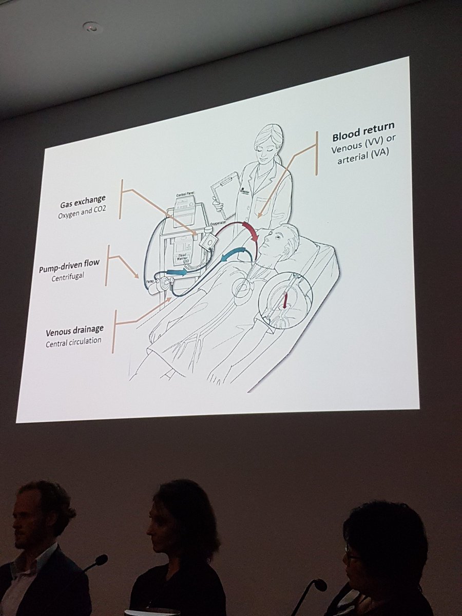 David Monks 🇮🇪 (@drdavidmonks) on Twitter photo Thanks to <a href="/learnECMOteam/">learnECMOteam</a> for a great session & 3 interesting cases. Like the description of VV ECMO as "lung dialysis". #ACEM17 Thanks to <a href="/learnECMOteam/">learnECMOteam</a> for a great session & 3 interesting cases. Like the description of VV ECMO as "lung dialysis". #ACEM17