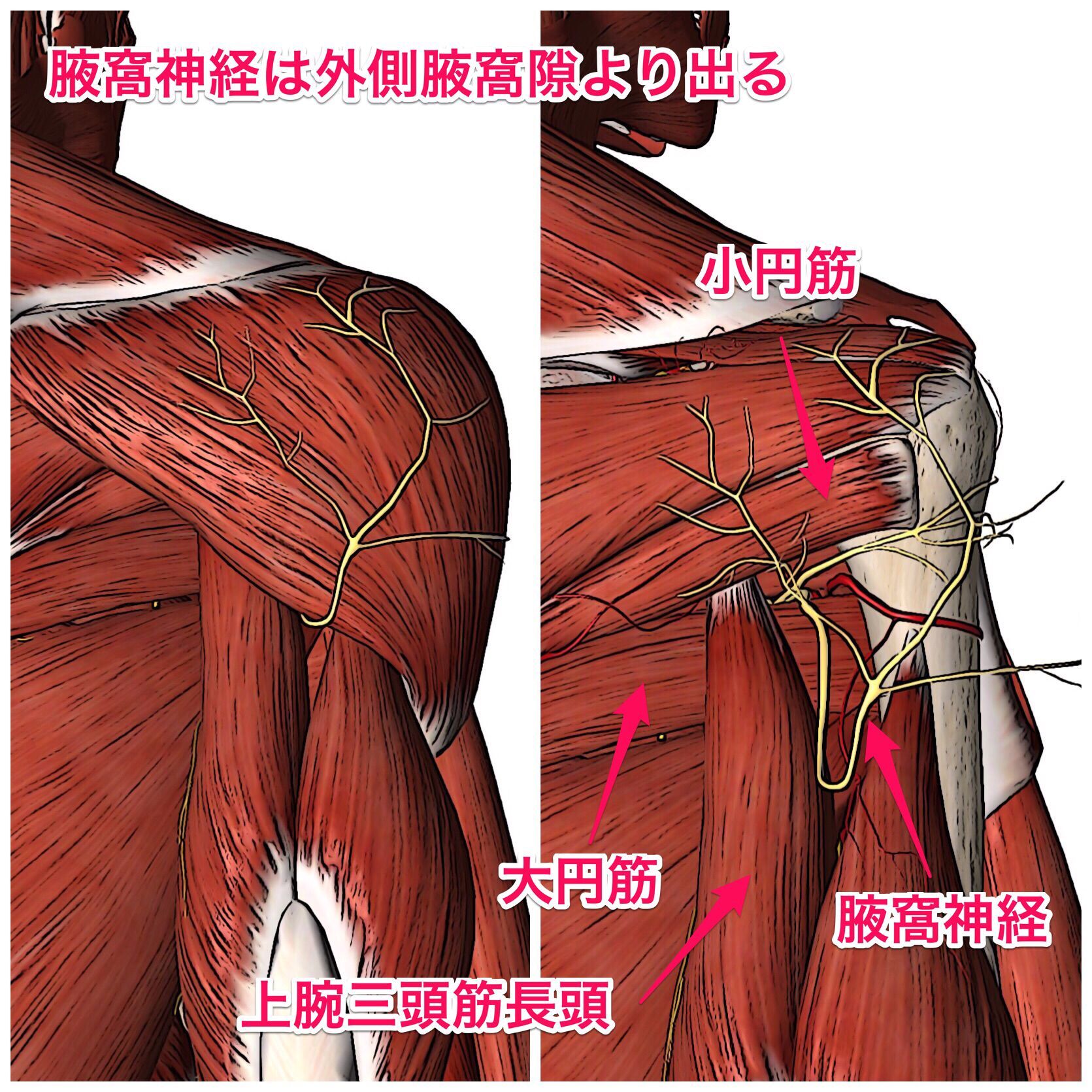 外側 腋窩 隙