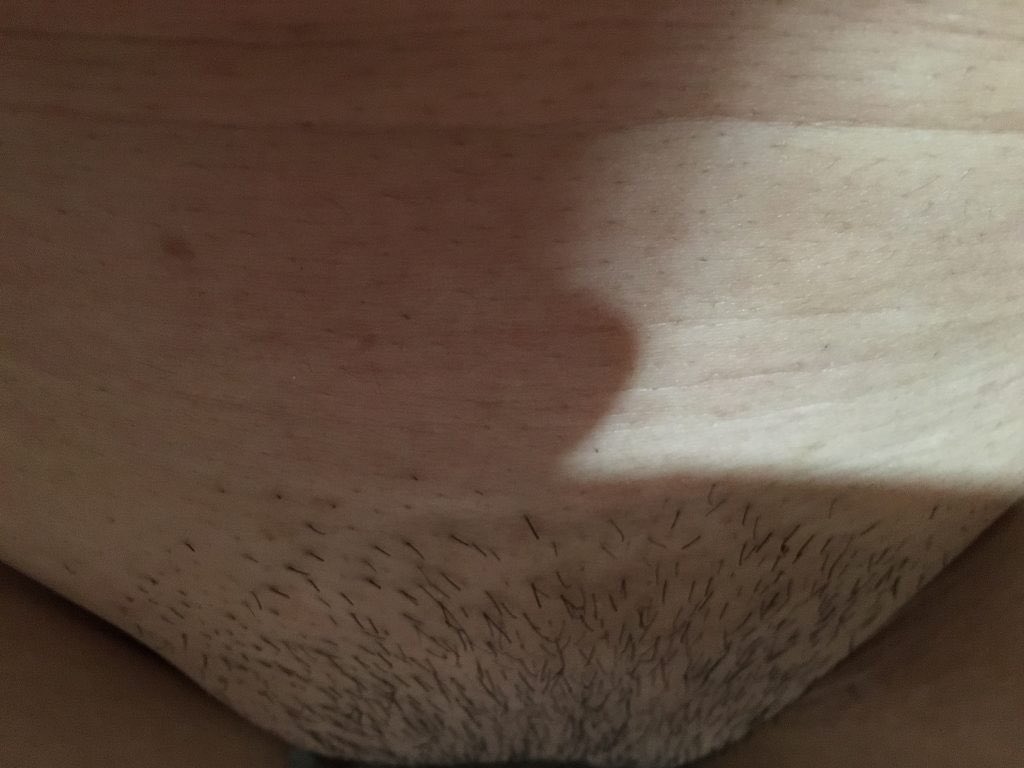 ㄷ골 on X: マン毛 全剃りしてパイパンにして ちょびちょび生え始めてっから なんか汚いごまみたい 汚ったね臭そ笑笑  t.co5vWlcLUAAr  X