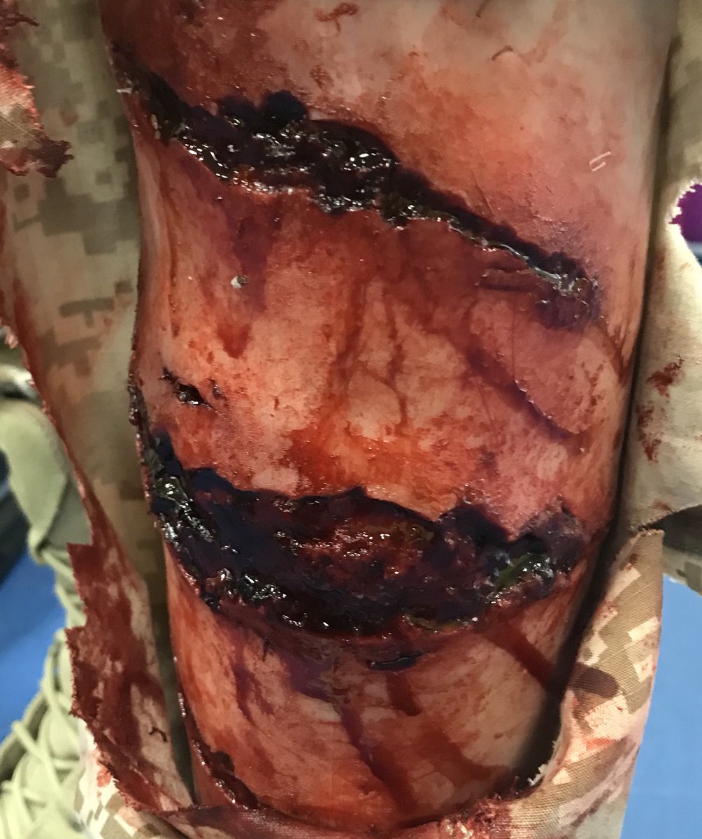 SIMBODIES's tweet photo. Enroute back from #AbuDhabi fantastic few days working with our partners @Prometheusmed training their team on #moulage effects and #simbodies! https://t.co/N2uMFlCnVU