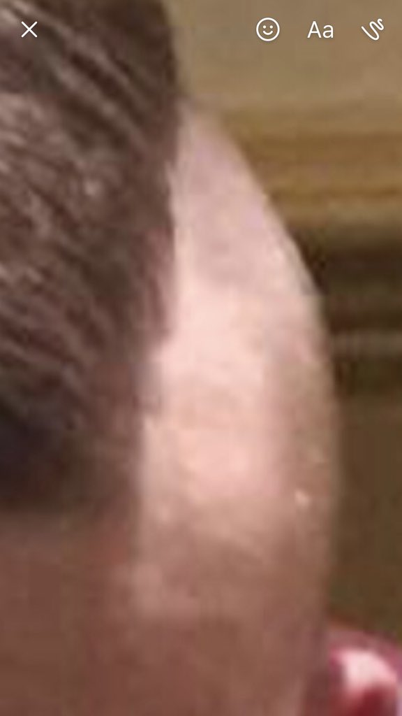 ThingsBleuSays's tweet photo. When you ask for 2 back and sides but the barbers from a scheme https://t.co/I6UjkLHI6I