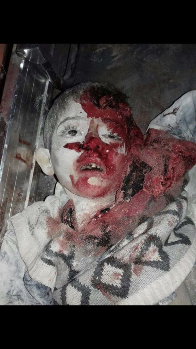 As_Alsharaa's tweet photo. The picture speaks.
Where's your voice against these daily #Putin_Assad crimes?Where's the world, @UN &amp; those who claim to care? #Syria #UN #ENICEF StopAssadCrimes PutinCrimes #Save ChildrenOfSyria https://t.co/VKshMi16KH