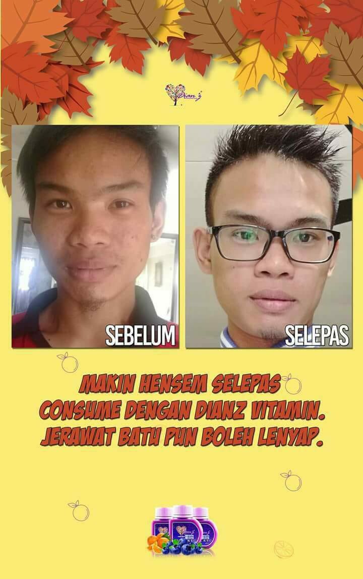 dianz_vit's tweet photo. Ingat perempuan je nak kulit cantik?
boboi pun nak kulit cun jugak 😁😝
consume #dianzvitamin je. rawat segala parut ,jerawat, exzema, resdung &amp; cerahkan kulit! https://t.co/1e62ItoK7D