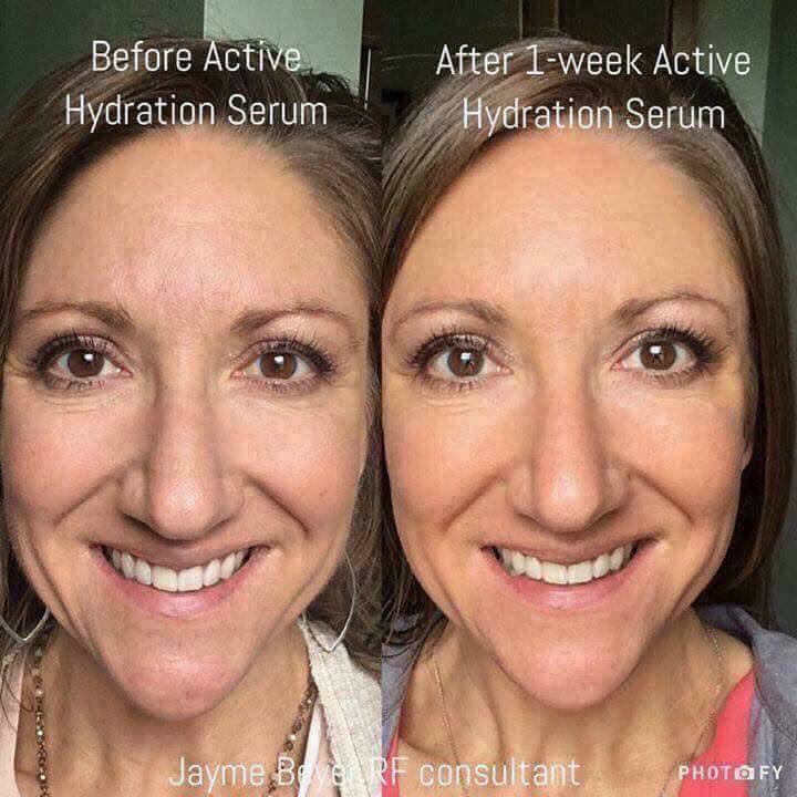 Casey_f's tweet photo. Trade dry flaky skin in for a fresh dewy glow this winter. I’ve got Rodan + Fields Active Hydration Serum for 10% off today only! #gift #skincare #sale #caseyscircle #DWTS #thanksgivingweek #VSFashionShow https://t.co/YeRAzs94cf