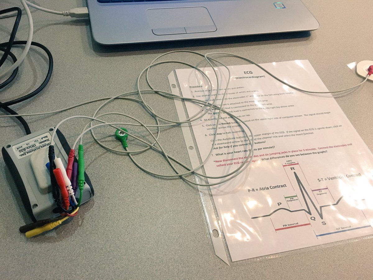 EllieMaeMatlock's tweet photo. Electrocardiograms & Spirometry @ClarksonCollege #RMSHal #WeAreRMS #HandsOnLearning #proud2bMPS https://t.co/ENhxxtTktk