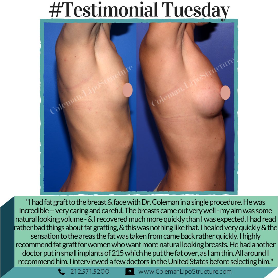 Lipostructure's tweet image. #TestimonialTuesday We 💕 this recent review from one of our patients &amp;amp; HAD to share it! She is thin so had implants placed w/ Dr. Coleman filling around them &amp;amp; her bony chest w/ fat to achieve the fullness w/ a very natural look!  #BreastAug #Review  #FatGrafting #PlasticSurgery