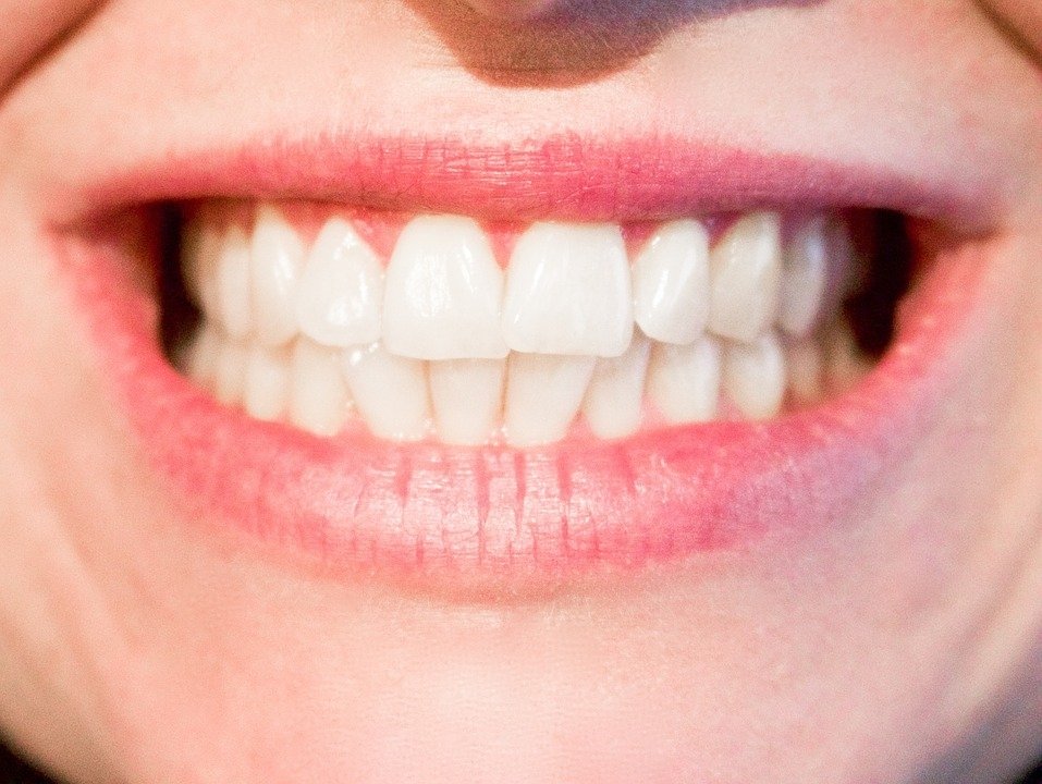 PrairieHawkDent's tweet image. Tooth contouring can change your smile! Read how: goo.gl/D4d81n