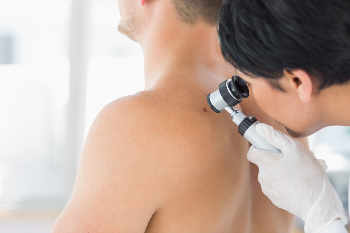 What Australians need to know about skin cancer, by Dr Andrew Miller, president of <a href="/DermatologyACD/">DermatologyACD</a>  ht.ly/MvCY30gJGyC